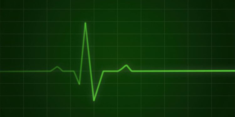 heartbeat monitor